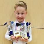 Dancer Eden Barbé, from Southport, is performing a danceathon to raise money for Alder Hey Childrens Hospital in Liverpool after he was born with Craniosynostosis, which saw him need nine hours of surgery to reconstruct his skull